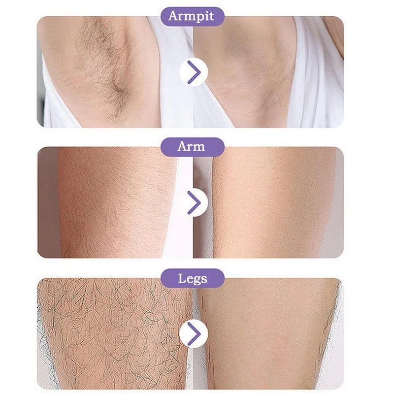 Crystal Epil Hair Removal Eras - Hair Removal Cream 评论和价格